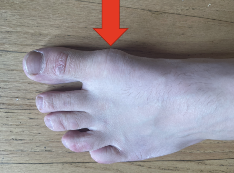 Big Toe Pain 5 Causes of a Painful Big Toe Dr. Justin Dean