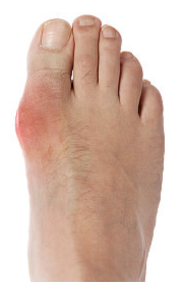 Big Toe Pain: 5 Causes of a Painful Big Toe - Dr. Justin Dean