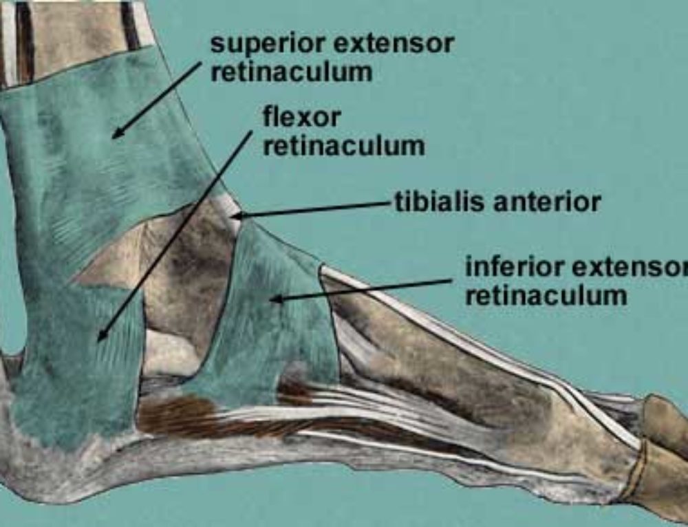 Baxter’s Neuropathy