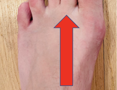 big toe and arch pain