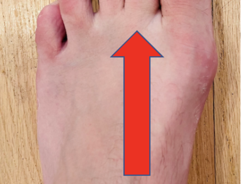 flexor-retinaculum-of-the-foot-retinacula-injuries-and-treatment-dr