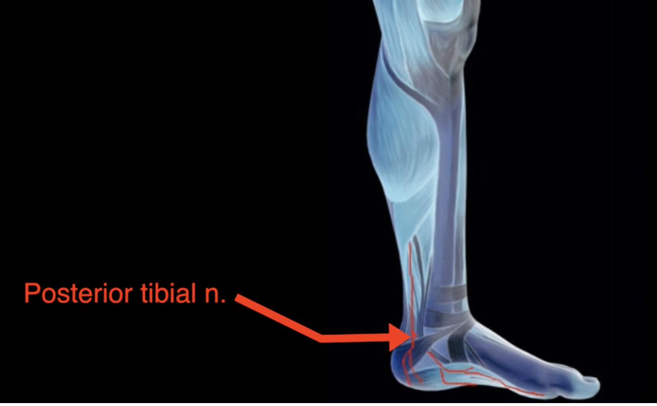 High Arched Feet Causes, Diagnosis, and Treatment