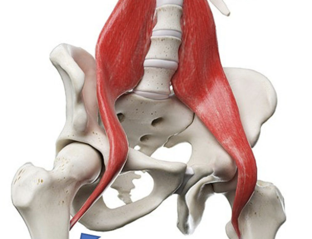 Ischial bursitis: Ischiogluteal pain - Dr. Justin Dean