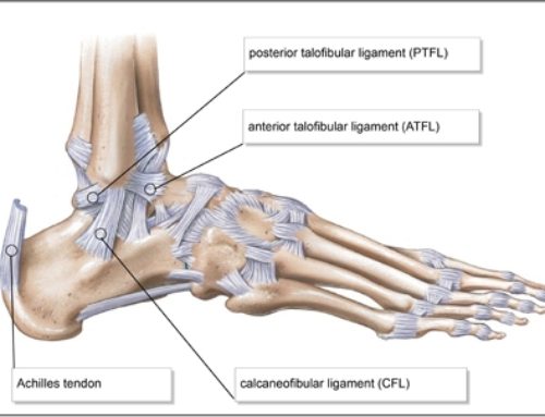 Anterior Talofibular Ligament: Ankle Sprain (ATFL)