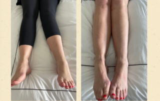 Before and After Treatment of a patient with knee pain in Los Angeles