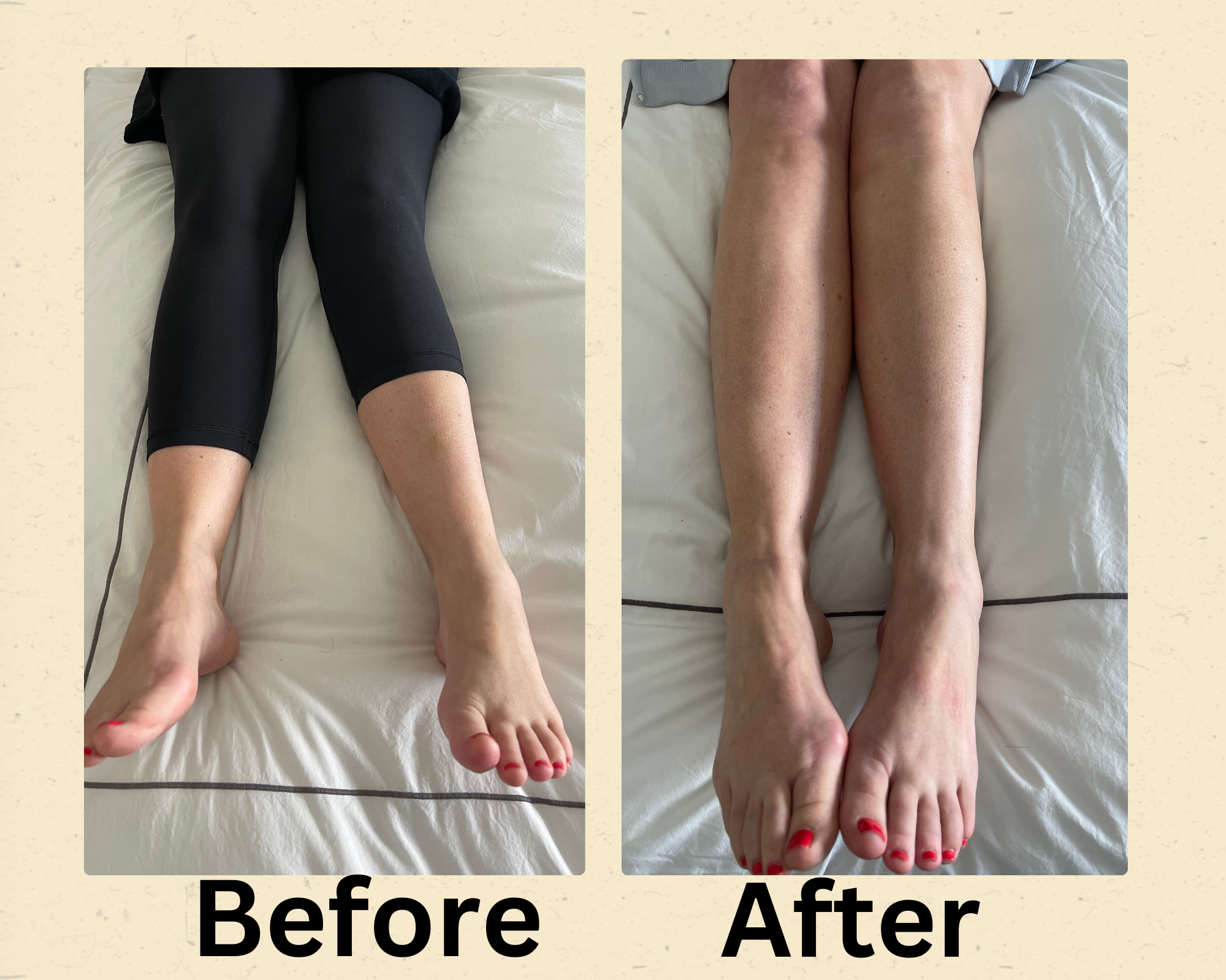 Before and After Treatment of a patient with knee pain in Los Angeles