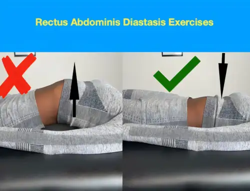 Rectus Abdominis Diastasis Exercises: Heal Your Rectus Abdominis Diastasis with These Effective Exercises!