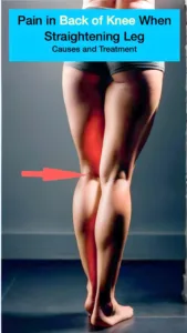 A example of a women that has pain behind the knee when attempting to extend the leg.