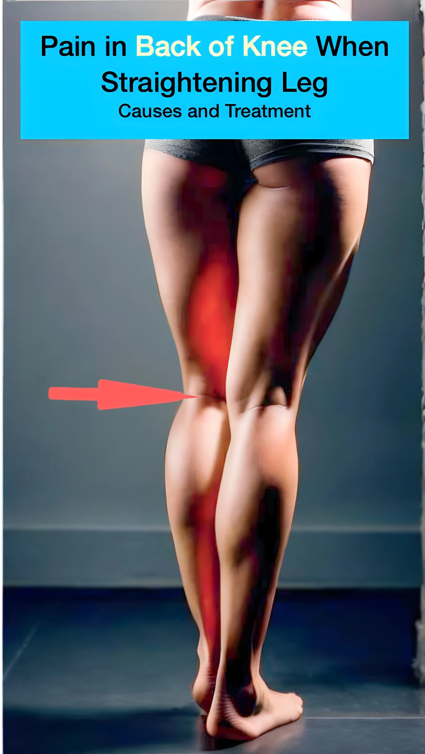 A example of a women that has pain behind the knee when attempting to extend the leg.