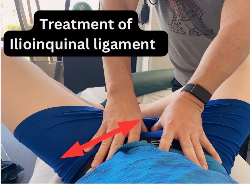 Manual therapy procedure for a patient with a painful ilioinquinal ligament 