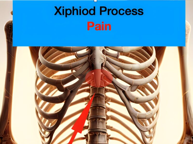 Xiphoid Process Pain: Relieve Chest Pain With Xiphoid Process Relief!